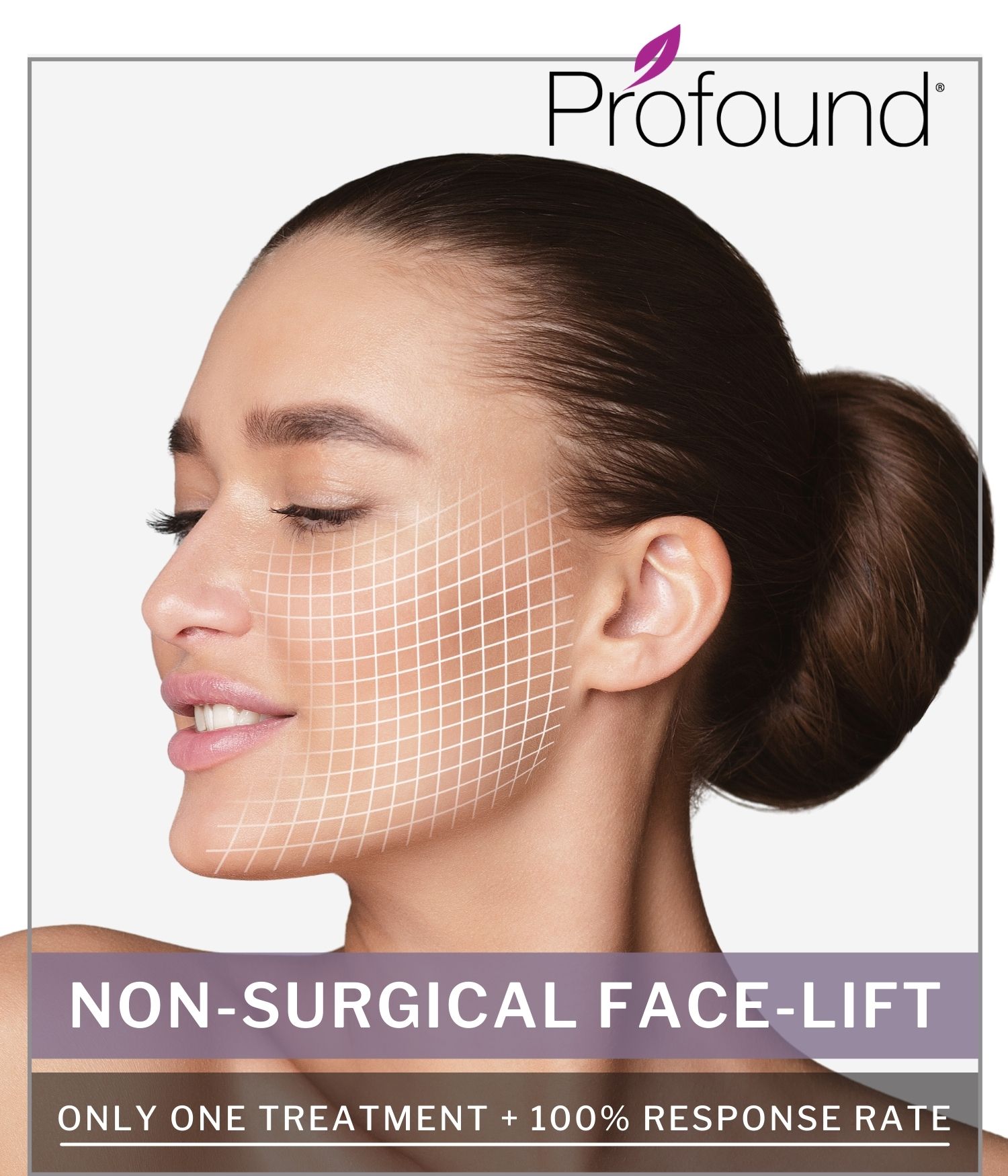 Profound® Non Surgical Face Lift Aesthetics Hawaii